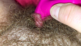 Toying My Fat Hairy Clit For Your Pleasure.