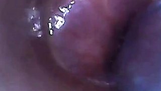 Endoscope POV Test Tube Cock Urethral Insertion