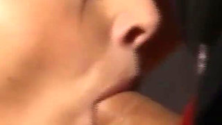 Anal casting