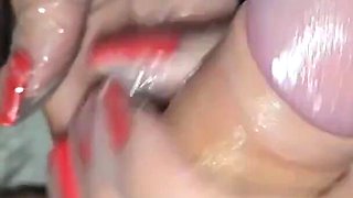 A Nurse Takes Semen for Analysis