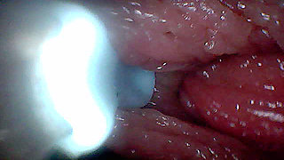 Visual Guide to G-Spot Stimulation and Orgasm - Endoscopic Perspective