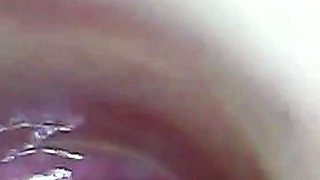 Endoscope POV: Test Tube Cock Urethral Insertion