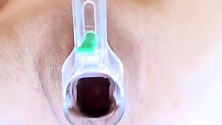 Speculum teen enjoys objects insertion
