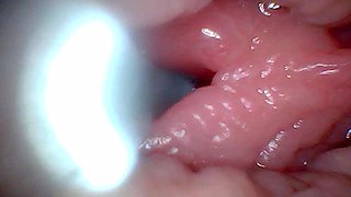 First Time: an Endoscope Reveals the G-spot up Close - Without Mounting!