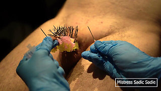 107 Needles CBT