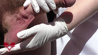 Medical penis stimulation