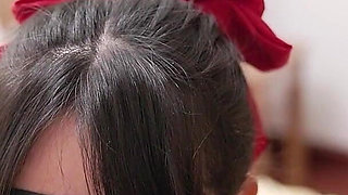 Binding Bracket Fixation