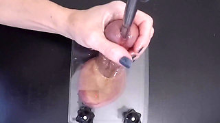 Compilation of Extreme but Effective Sperm Extraction Methods