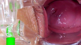 Cervical exam of chubby young blonde Cayla Lyons by 2 doctors