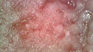 Medical Endoscope Oral Exam: Gummy Chewing, Extreme Teeth & Tongue Macro