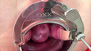 Masked Schoolgirl Extreme Cervix View and Double Vaginal Fisting