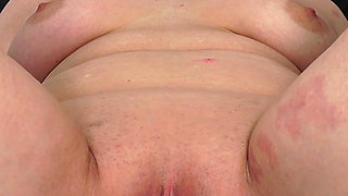 Mature Gyno Exam-Cervix examination with speculum + vaginal irrigation